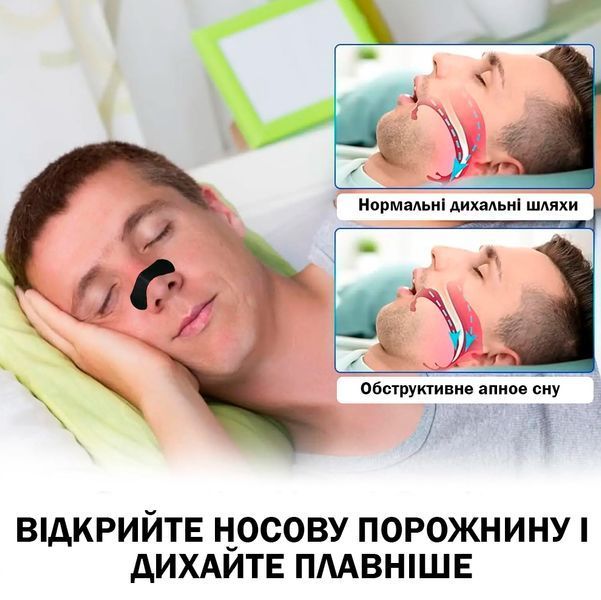 Полоски для улучшения дыхания Носовой патч против храпа 30 шт 117500 фото