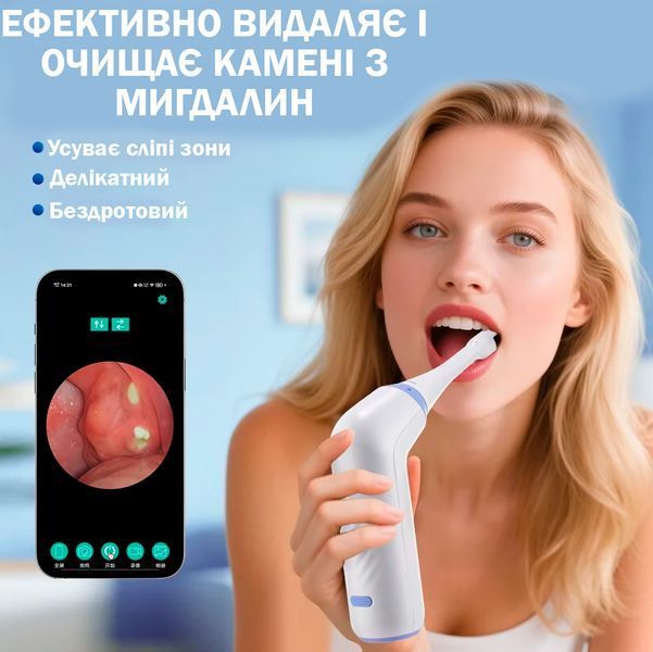 Електричний вакуумний набір з камерою для видалення тонзилолітів Інструмент для видалення каменя з мигдалин з підсвіткою і насадками 117431 фото