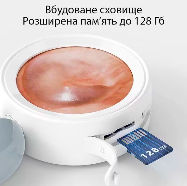 Портативний візуальний отоскоп із IPS-дисплеєм для очищення вух з 12 насадками 2000 мАг Type-C 117603 фото