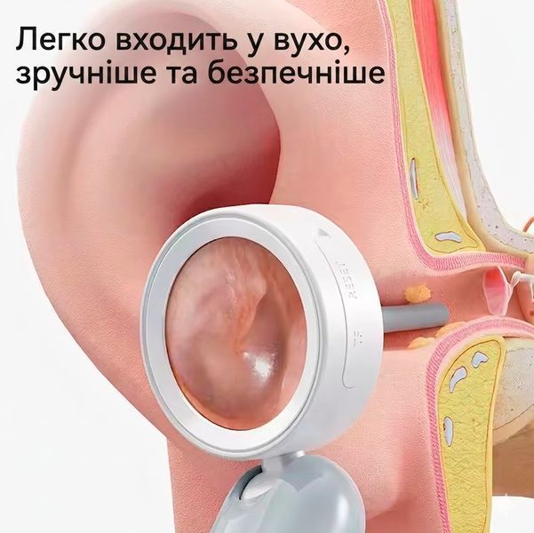 Визуальный портативный отоскоп с IPS-дисплеем для очистки ушей с 12 насадками 2000 мАч Type-C 117603 фото